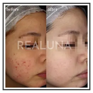 REALUNA所属・REALUNA CHIHIROのエステ・リラクイメージ