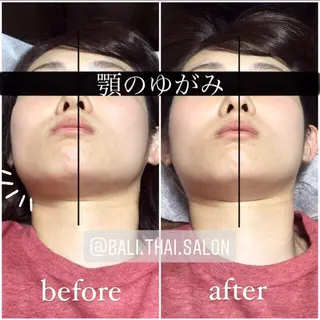 🌈歪み改善🌈 バリンタイ すぎうらのエステ・リラクイメージ