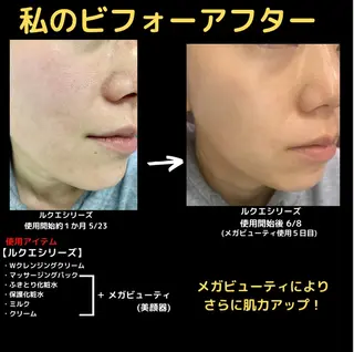 ミューズエステ 谷口美結のエステ・リラクイメージ