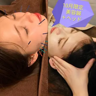 たるみ専門美容鍼 × 猫背整体 のぐち所属・小顔と姿勢改善のプロ ｜整体と美容鍼のぐちのエステ・リラクイメージ