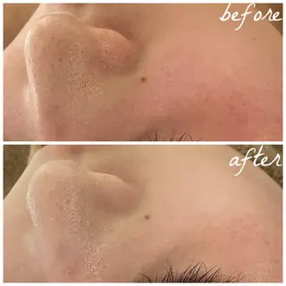 メンズ メナード岐阜茜部 杉浦のエステ・リラクイメージ