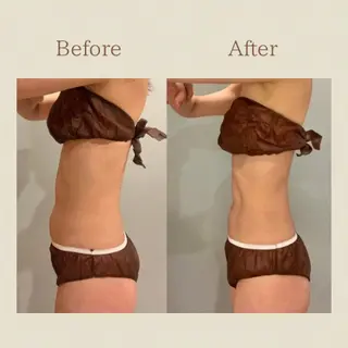 お腹痩せエステ Flat BELLY 恵比寿所属・【腸もみ/脂肪冷却】 お腹エステ/恵比寿のエステ・リラクイメージ