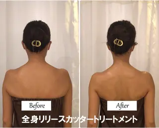 痩身×フェイシャル ブライダル|Linoのエステ・リラクイメージ