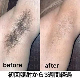 メンズ 【ena】 YUKOのマツエク・マツパデザイン