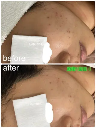 志免町 フェイスシャルエステのエステ・リラクイメージ