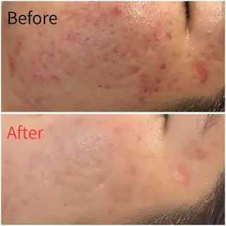 MORE BEAUTY ESTHE 本通り店所属・more 𓍯 のその他イメージ