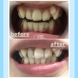 メンズ お手軽ホワイトニングsalon mina所属・武元 奈津美のその他イメージ