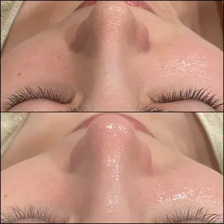 LiZA エステティックサロンのエステ・リラクイメージ