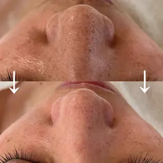 つや肌スペシャリスト 田中美沙のエステ・リラクイメージ