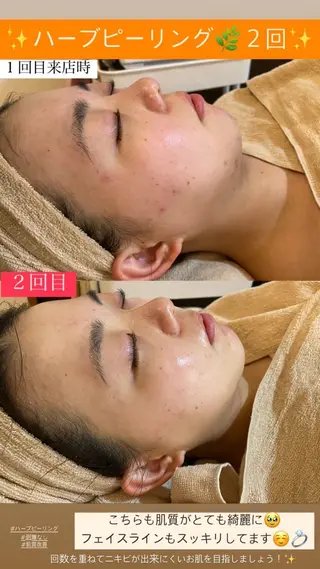 Salon de Lino 御器所のエステ・リラクイメージ