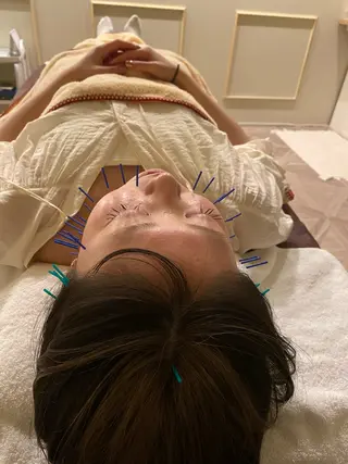 美容鍼/ヘッドスパ/ 💎さかもとのエステ・リラクイメージ