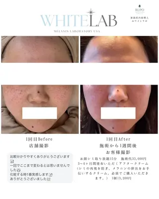 RUPO THE MAINTENANCE新潟店【ローマピンク公式認定店/ララピール正規店/骨格小顔】所属・オーナー Nanjoのエステ・リラクイメージ