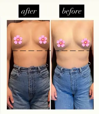 private salon Rions所属・育乳/整体/痩身 サロンRIONSのエステ・リラクイメージ