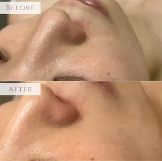 EPIL Beauty Salon所属・akane .のエステ・リラクイメージ