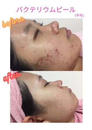 透明感の肌Lino malieのエステ・リラクイメージ