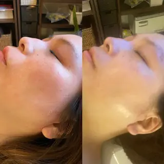 MiEL  total beaty salon所属・肌質改善サロン ナツコのエステ・リラクイメージ