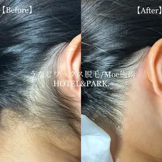 HOTEL&PARK .Moeワックス脱毛のエステ・リラクイメージ