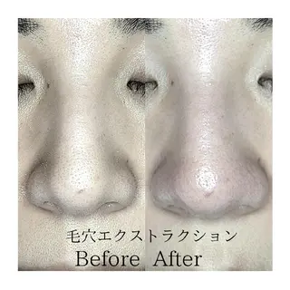  毛穴洗浄・まつ毛 の専門店 ソラーレのエステ・リラクイメージ