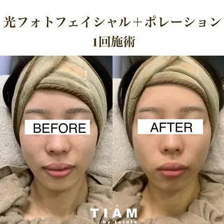 美肌サロンTIAM by tetoteのエステ・リラクイメージ