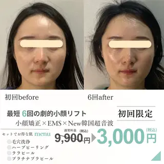 最速小顔・肌質管理 ❣️エスポワールのエステ・リラクイメージ
