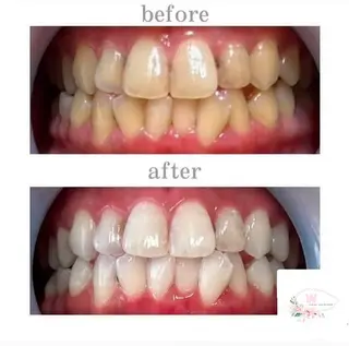 ホワイトニングショップ本厚木所属・ホワイトニング ショップ本厚木のその他イメージ