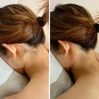 うなじ脱毛/美肌脱毛 LABELのエステ・リラクイメージ