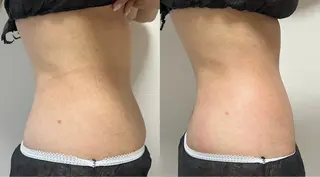 Beauty   Salon  Adiy所属・Adiy ikumiのエステ・リラクイメージ