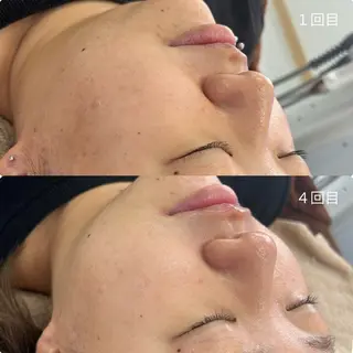 Venus所属・エステサロン Venusのその他イメージ