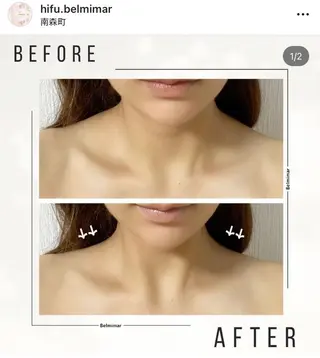 南森町・肌質改善 BELMIMARのエステ・リラクイメージ