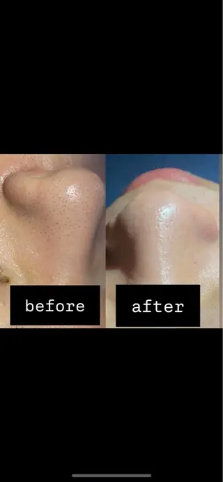 Nico laugh所属・ボディー＆肌質改善 Nicolaughのエステ・リラクイメージ