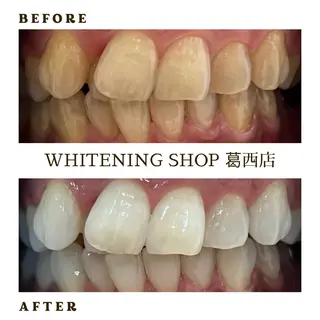 メンズ ホワイトニング ショップ葛西店のその他イメージ