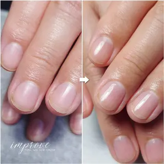 ネイル improve /mamiのネイルデザイン