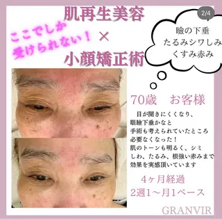 【福岡市西区 エステ】 GRANVIR(グランヴィール)所属・GRANVIR グランヴィールのエステ・リラクイメージ