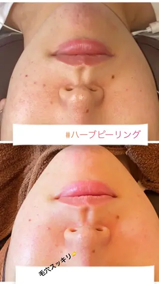 FLEUR大阪・整体 ・ハイフ・痩身・小顔のエステ・リラクイメージ