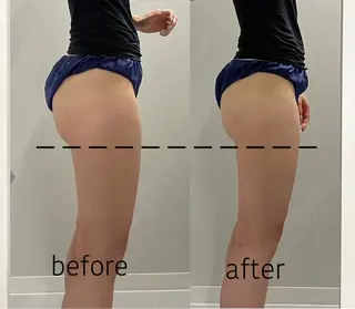 ENCHANT 脱毛.小顔.毛穴のエステ・リラクイメージ