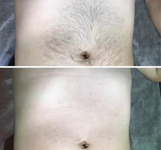 メンズ プライベートサロンBRAG所属・プライベートサロン BRAG🏠男女OKのエステ・リラクイメージ