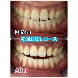 プラチナムビューティー柏所属・【歯科提携】柏ホワイ トニングスタイルのその他イメージ