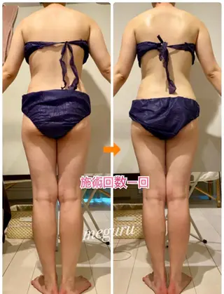 ショート カラー パーマ ヘアアレンジ メンズ キッズ ネイル マツエク・マツパ 痩身&ボディ 結果出し🌟丹野のエステ・リラクイメージ