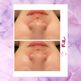 ☆痩身/小顔☆ 結果出します☆のエステ・リラクイメージ