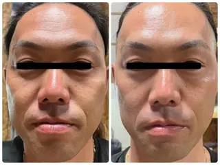 Eyelash Salon 4Uのマツエク・マツパデザイン