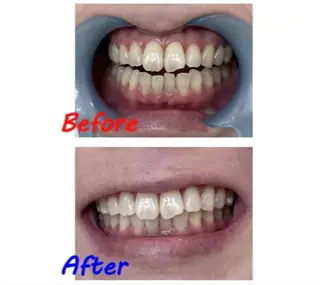 セルフホワイトニングサロン　ラヴィアン所属・ホワイトニングサロン La vie enのその他イメージ