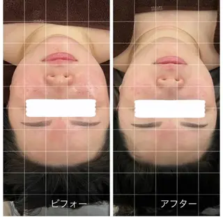 Relaxsalon undo所属・Relaxsalon undoのエステ・リラクイメージ
