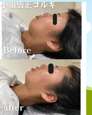 高岳/久屋大通　脱毛 コルギ🌿ENSHIのエステ・リラクイメージ