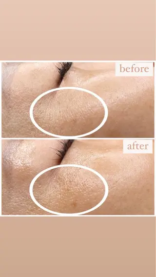 立体小顔×艶肌×美ボ ディ似合わせ施術 岡のエステ・リラクイメージ