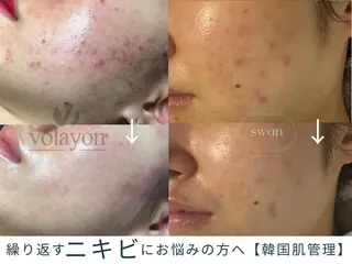 swan(スワン) 韓国肌管理 南堀江のエステ・リラクイメージ