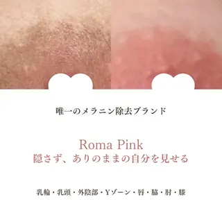 強力痩身専門サロン /ローマピンク導入店のその他イメージ