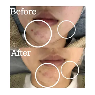 BestBelleꕤ 大阪福島/肌質改善のエステ・リラクイメージ