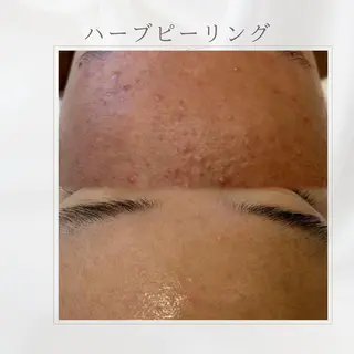 西区九条エステ MITUREIサロンのエステ・リラクイメージ