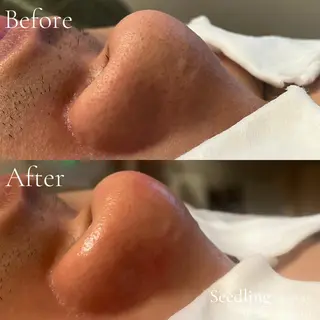 メンズ シードリン 府内店 小波のヘアスタイル