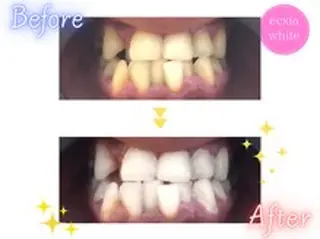 ecxia white 高田馬場所属・セルフホワイトニング エクシア 高田馬場のその他イメージ